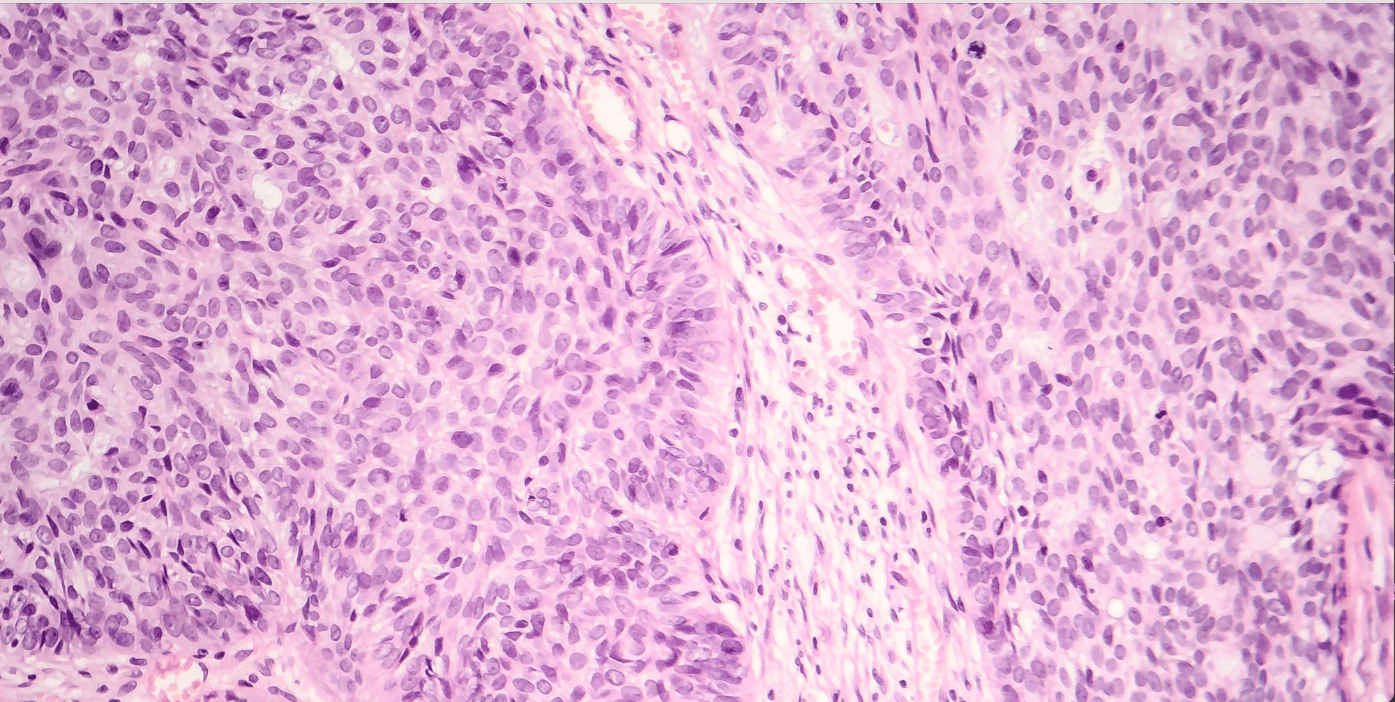 Understanding Inflammaging & Its Impact on Your Skin